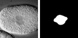 線虫胚画像とセグメンテーション